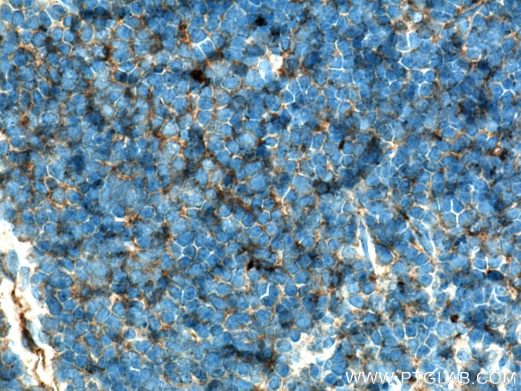 Immunohistochemistry (IHC) staining of mouse thymus tissue using CD7 Monoclonal antibody (60209-1-Ig)
