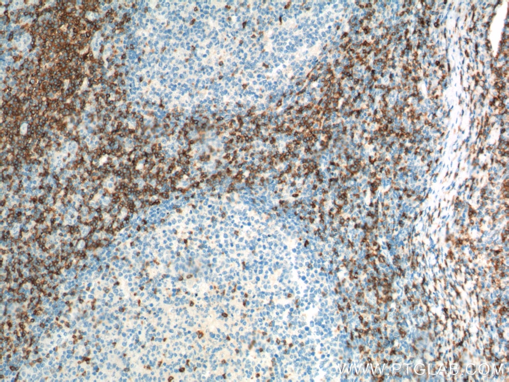 CD7 Monoclonal antibody