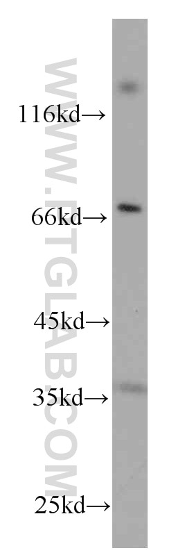 Western Blot (WB) analysis of Jurkat cells using CD7 Monoclonal antibody (60209-1-Ig)