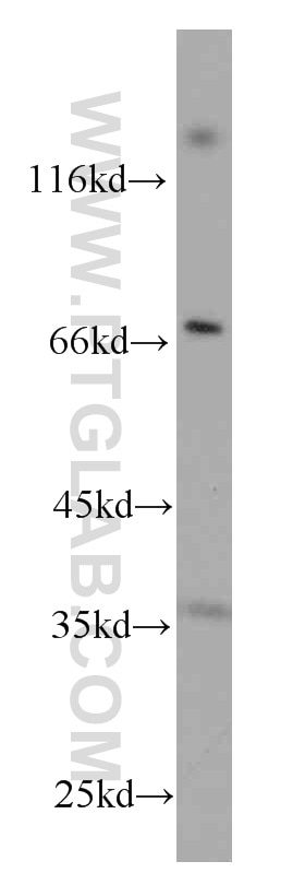 WB analysis of Jurkat using 60209-1-Ig