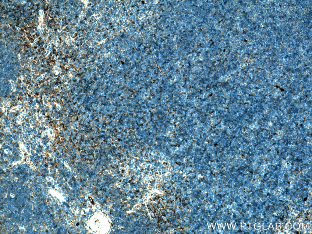 Immunohistochemistry (IHC) staining of mouse thymus tissue using CD7 Monoclonal antibody (60209-2-Ig)