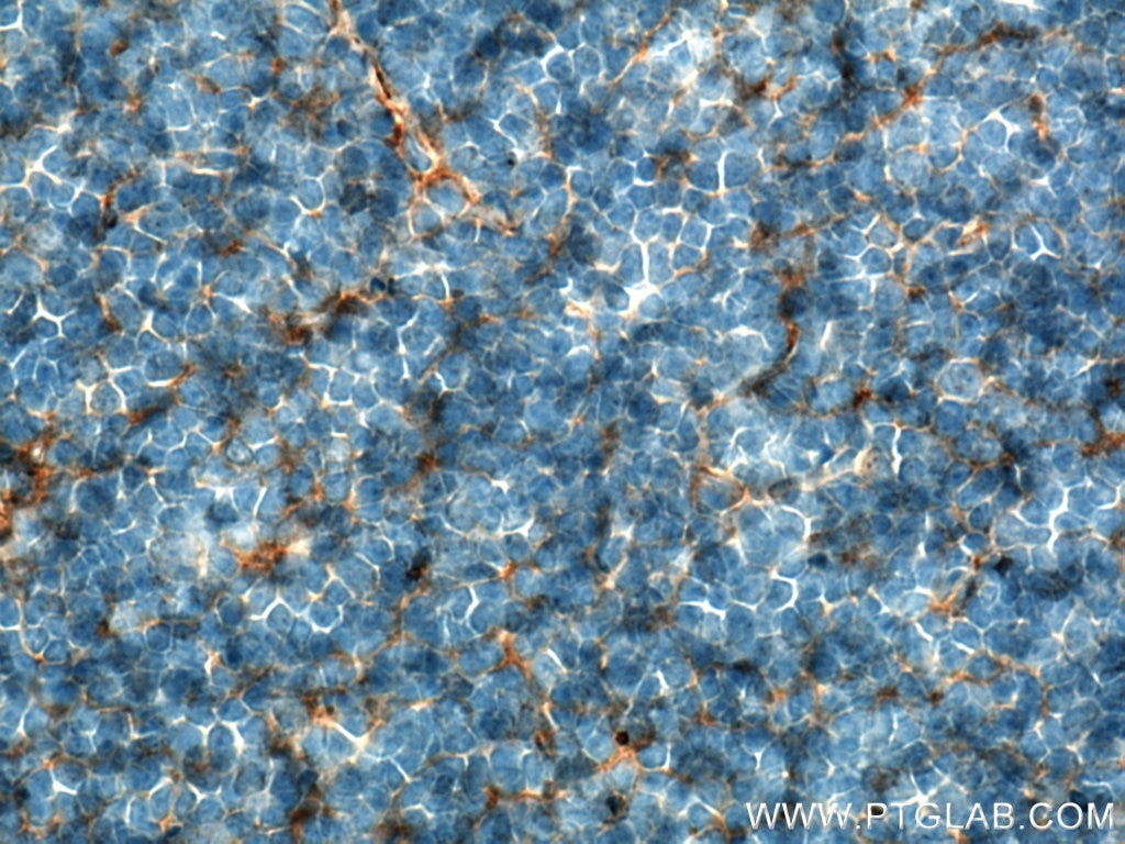 Immunohistochemistry (IHC) staining of mouse thymus tissue using CD7 Monoclonal antibody (60209-2-Ig)