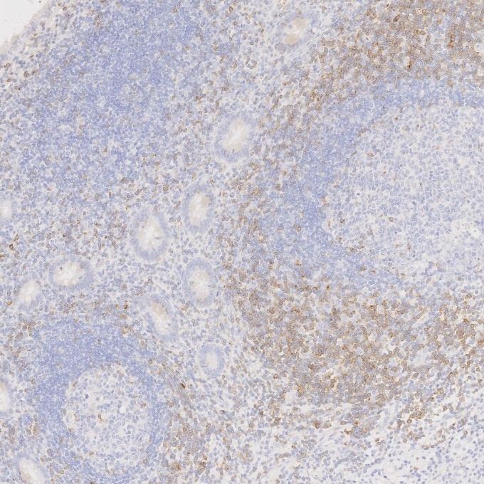 Immunohistochemistry (IHC) staining of human appendicitis tissue using CD7 Monoclonal antibody (60209-2-Ig)