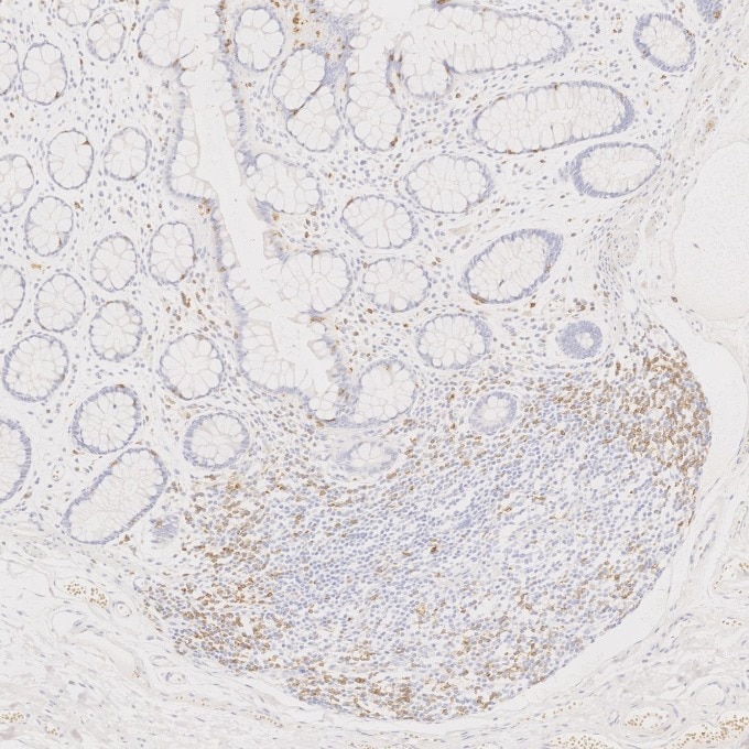 Immunohistochemistry (IHC) staining of human large intestine tissue using CD7 Monoclonal antibody (60209-2-Ig)