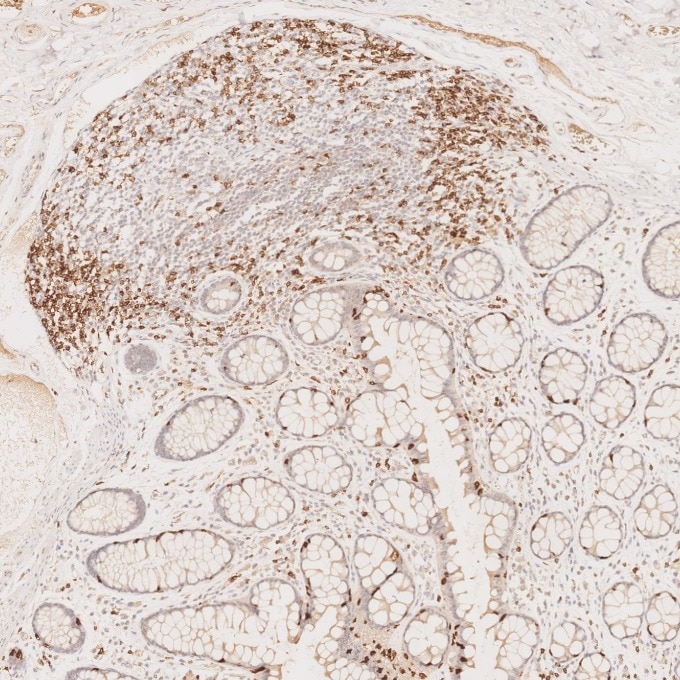 Immunohistochemistry (IHC) staining of human large intestine tissue using CD7 Monoclonal antibody (60209-2-Ig)
