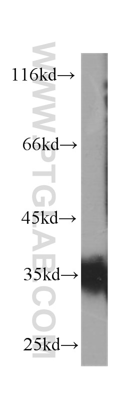 Western Blot (WB) analysis of Jurkat cells using CD7 Monoclonal antibody (60209-2-Ig)