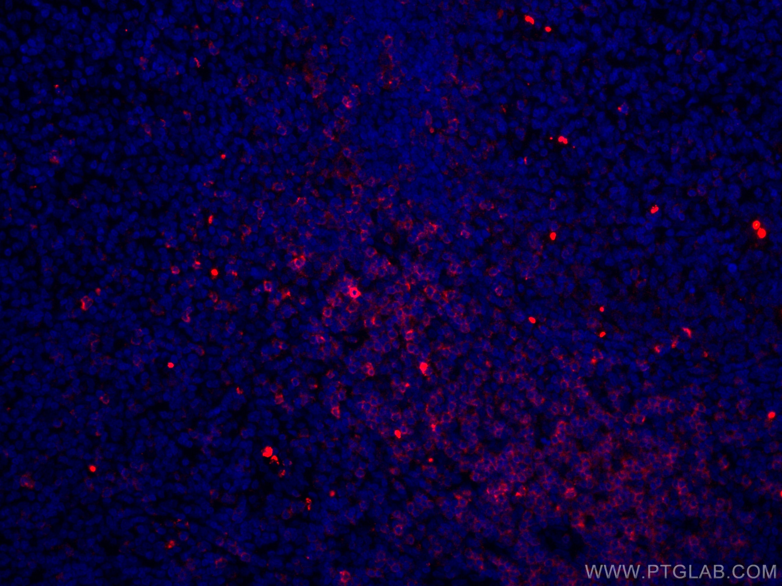 Immunofluorescence (IF) / fluorescent staining of human tonsillitis tissue using CoraLite®594-conjugated CD7 Monoclonal antibody (CL594-60209)