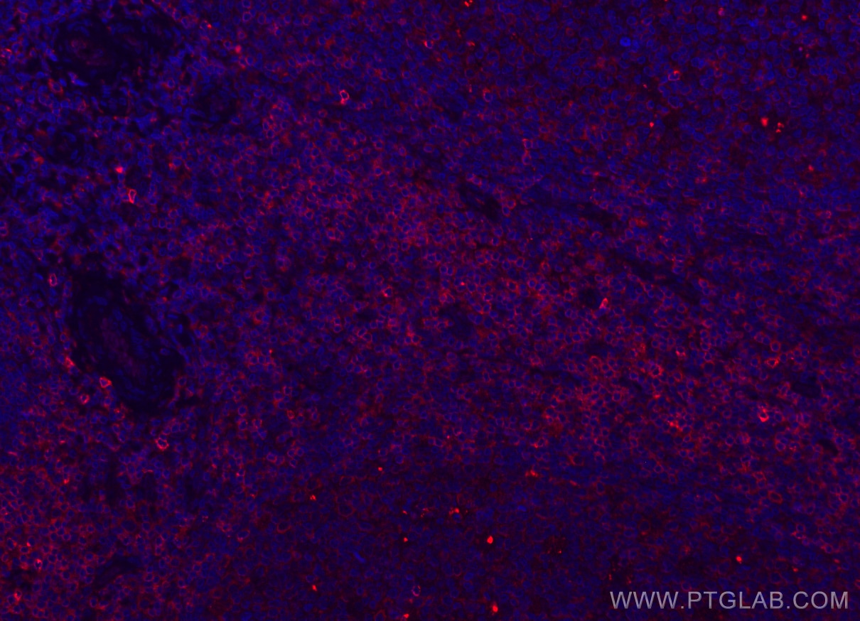 Immunofluorescence (IF) / fluorescent staining of human tonsillitis tissue using CoraLite®594-conjugated CD7 Monoclonal antibody (CL594-60209)