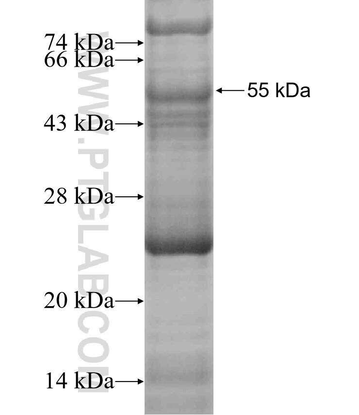CD7 fusion protein Ag1805 SDS-PAGE