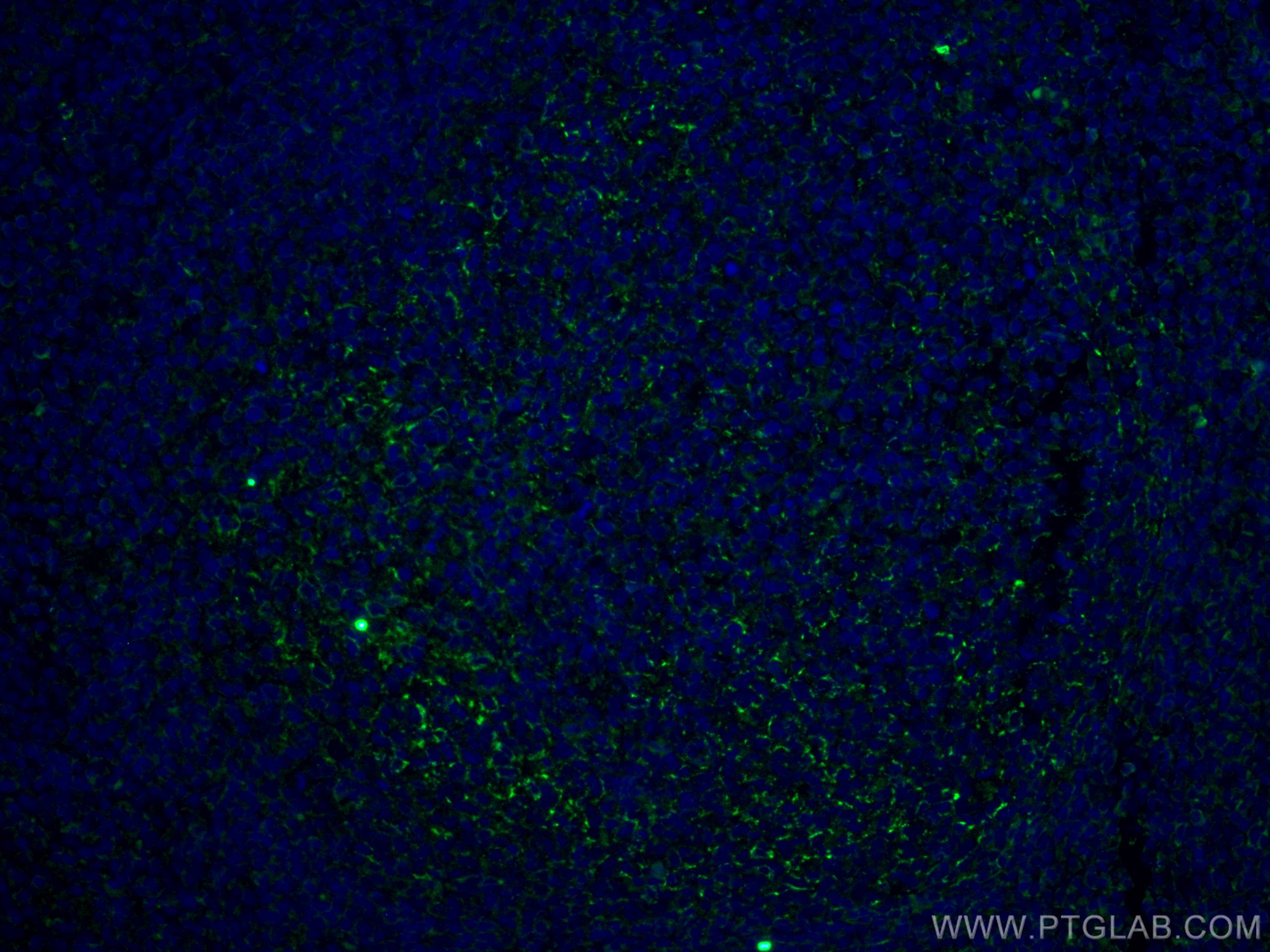 Immunofluorescence (IF) / fluorescent staining of human tonsillitis tissue using CD70 Monoclonal antibody (67749-1-Ig)