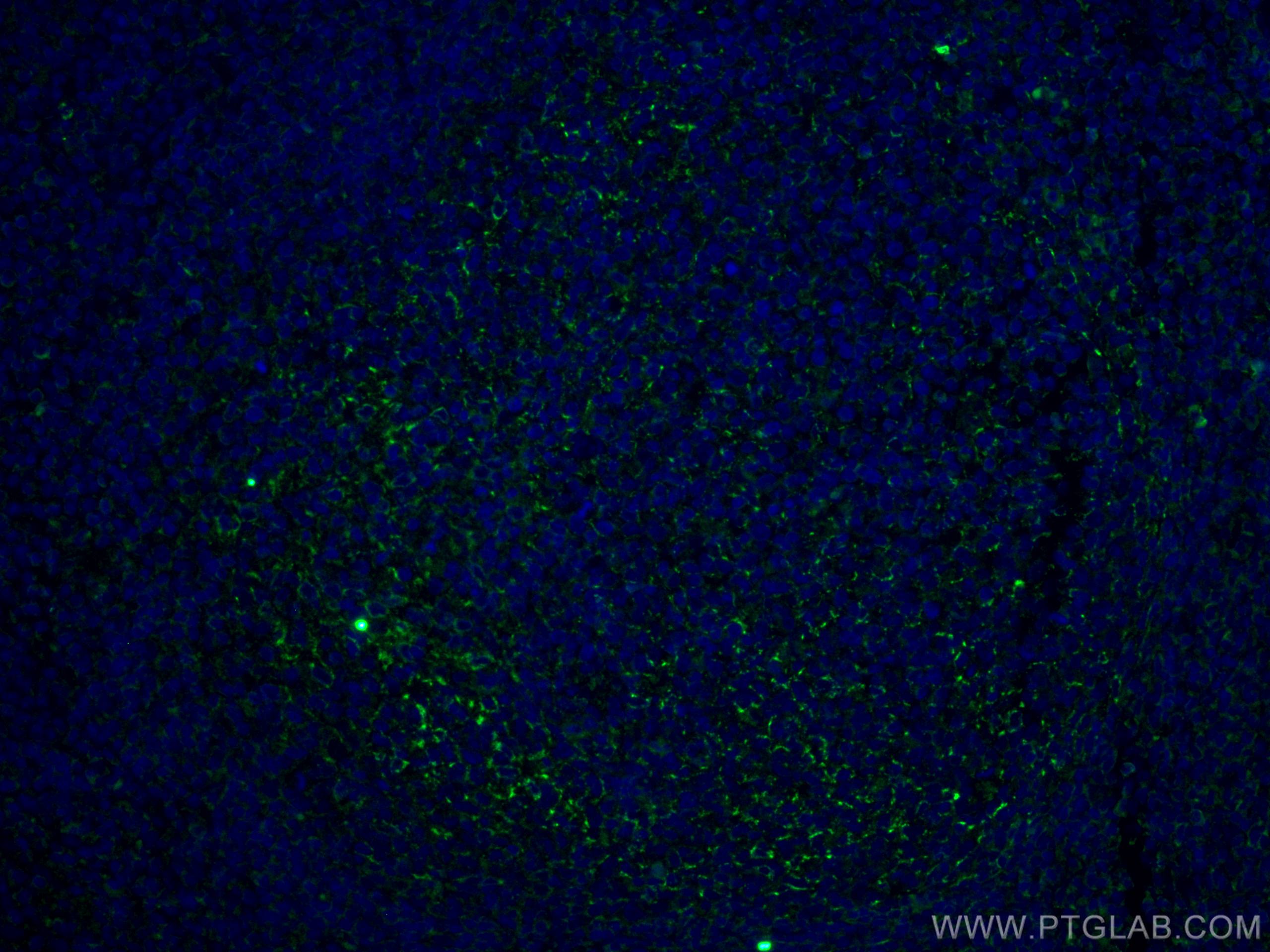 Immunofluorescence (IF) / fluorescent staining of human tonsillitis tissue using CD70 Monoclonal antibody (67749-1-Ig)