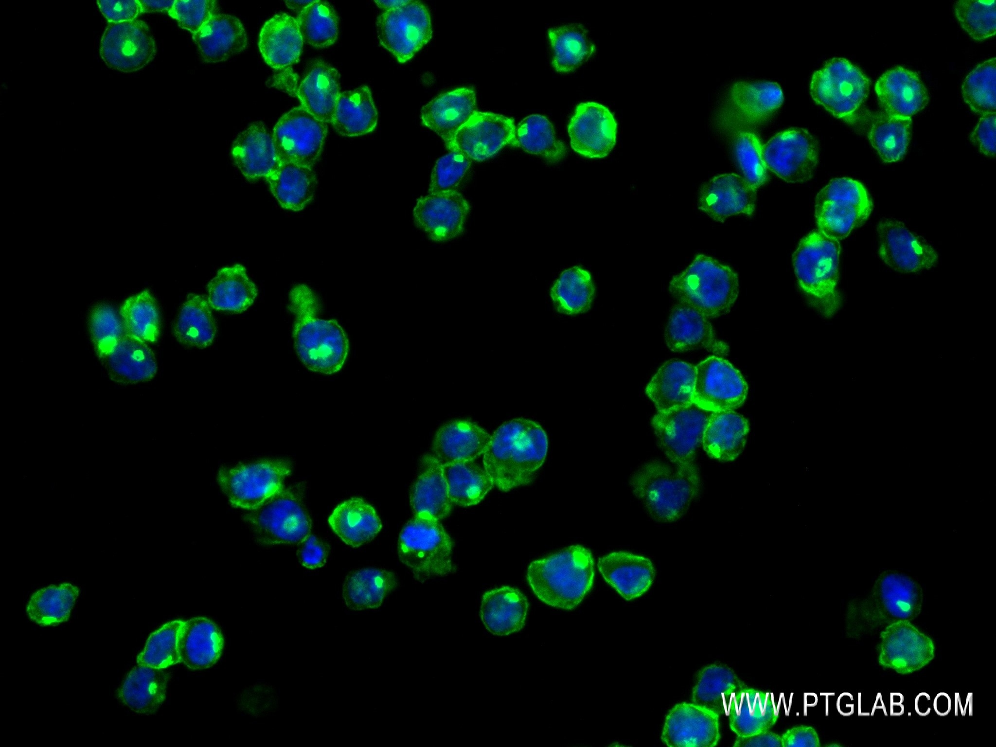 Immunofluorescence (IF) / fluorescent staining of THP-1 cells using CD70 Recombinant antibody (84455-2-RR)