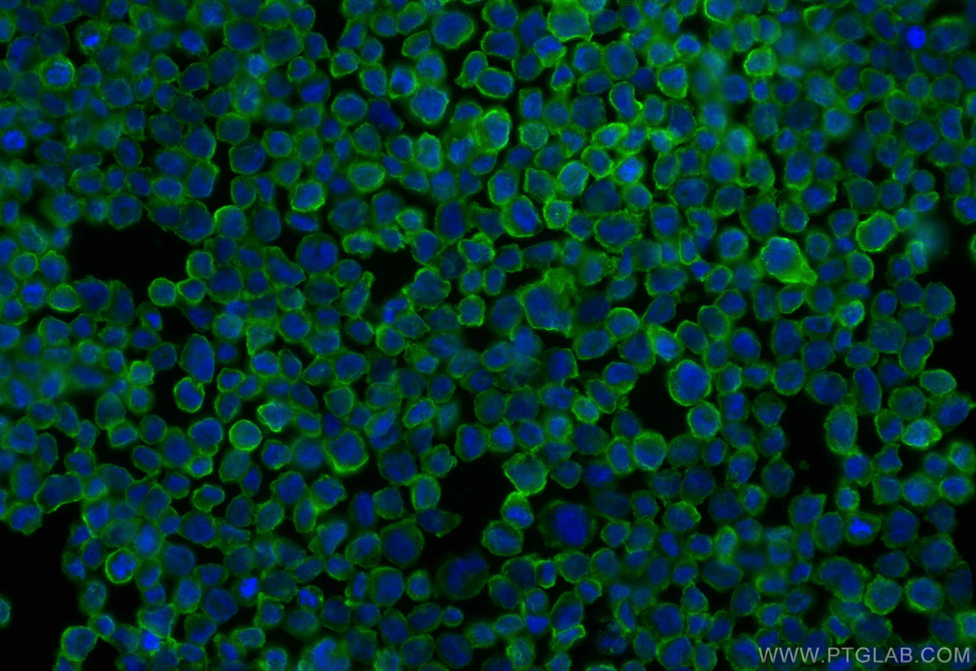 Immunofluorescence (IF) / fluorescent staining of THP-1 cells using CD70 Recombinant antibody (84455-2-RR)