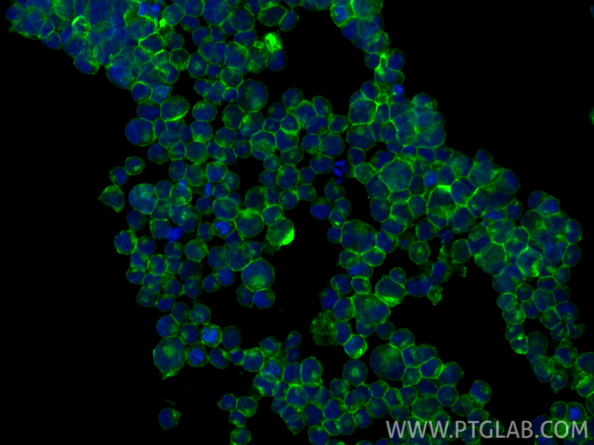 IF Staining of Raji using 84455-2-RR (same clone as 84455-2-PBS) Immunofluorescence (IF) / fluorescent staining of Raji cells using CD70 Recombinant monoclonal antibody (84455-2-RR)