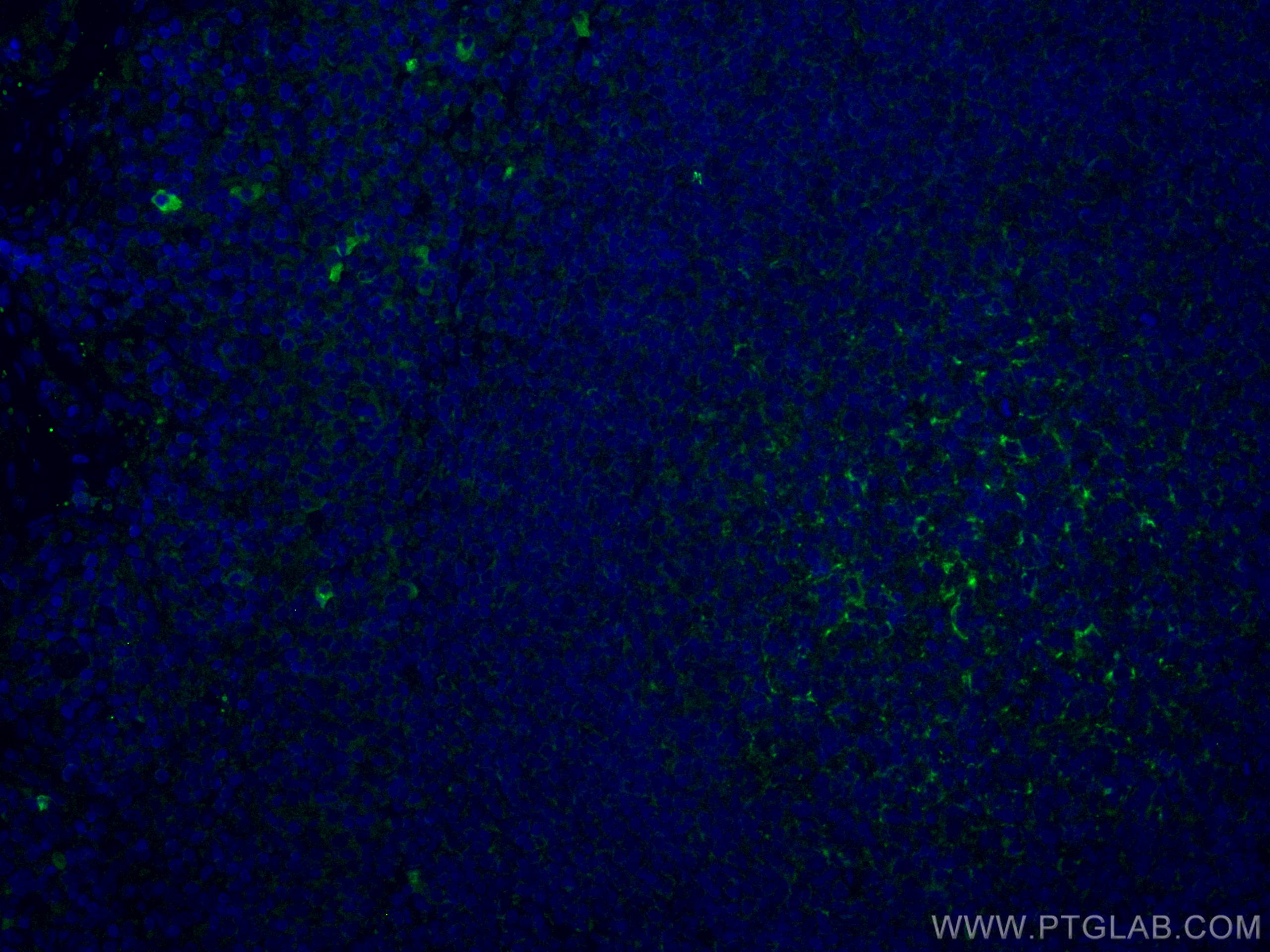 Immunofluorescence (IF) / fluorescent staining of human tonsillitis tissue using CoraLite® Plus 488-conjugated CD70 Monoclonal anti (CL488-67749)