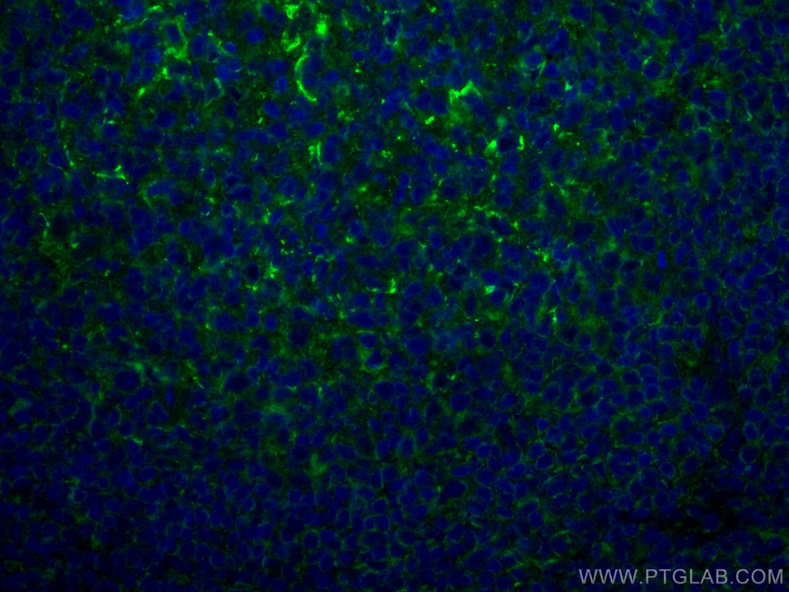Immunofluorescence (IF) / fluorescent staining of human tonsillitis tissue using CoraLite® Plus 488-conjugated CD70 Monoclonal anti (CL488-67749)
