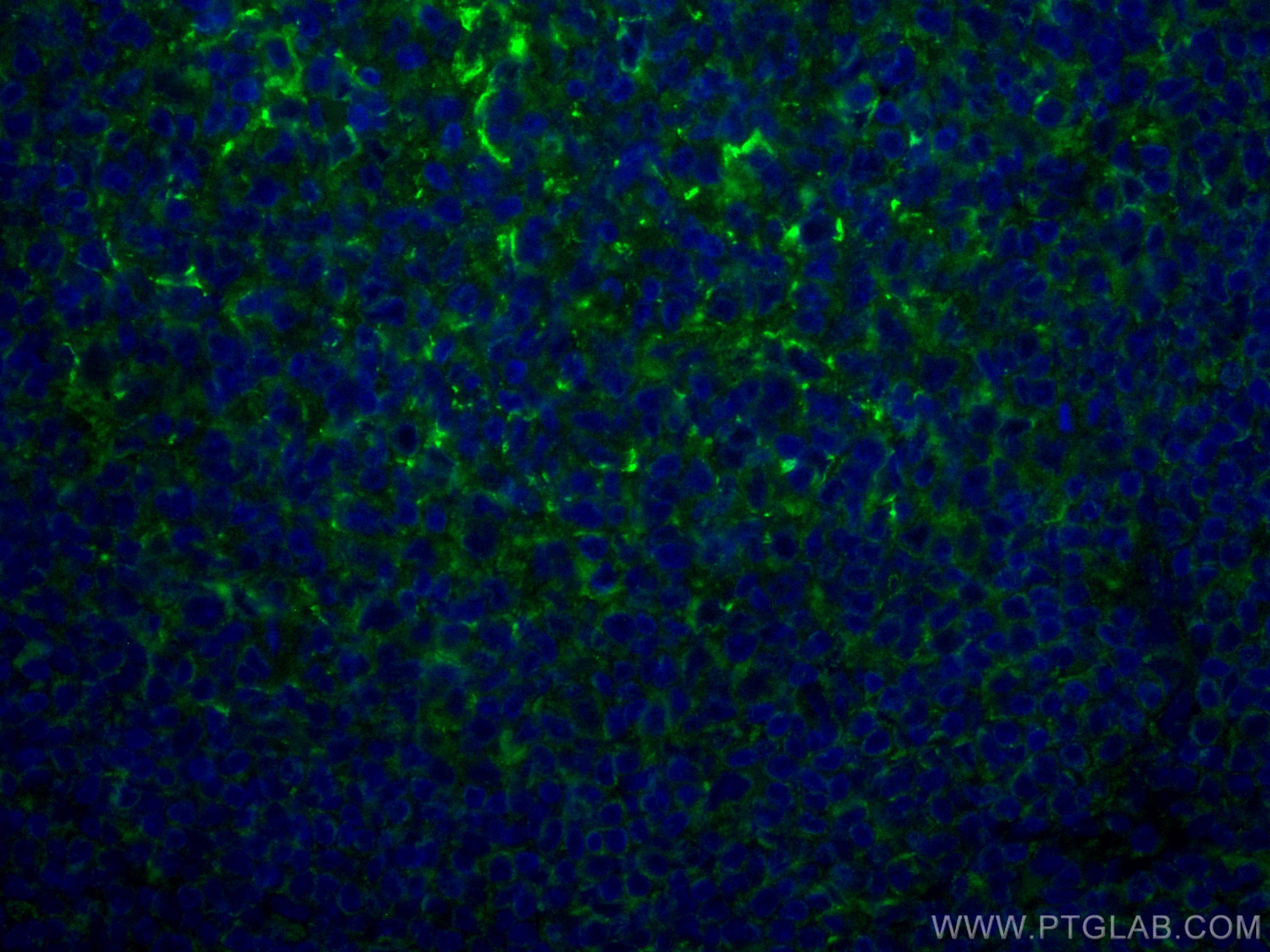 IF Staining of human tonsillitis using CL488-67749