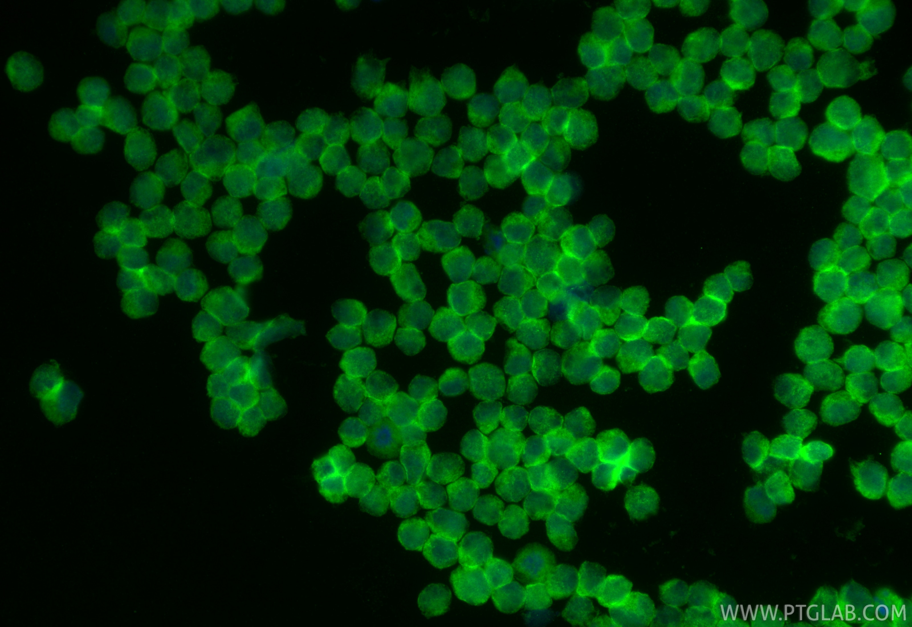 Immunofluorescence (IF) / fluorescent staining of Raji cells using CoraLite® Plus 488-conjugated CD70 Monoclonal anti (CL488-67749)