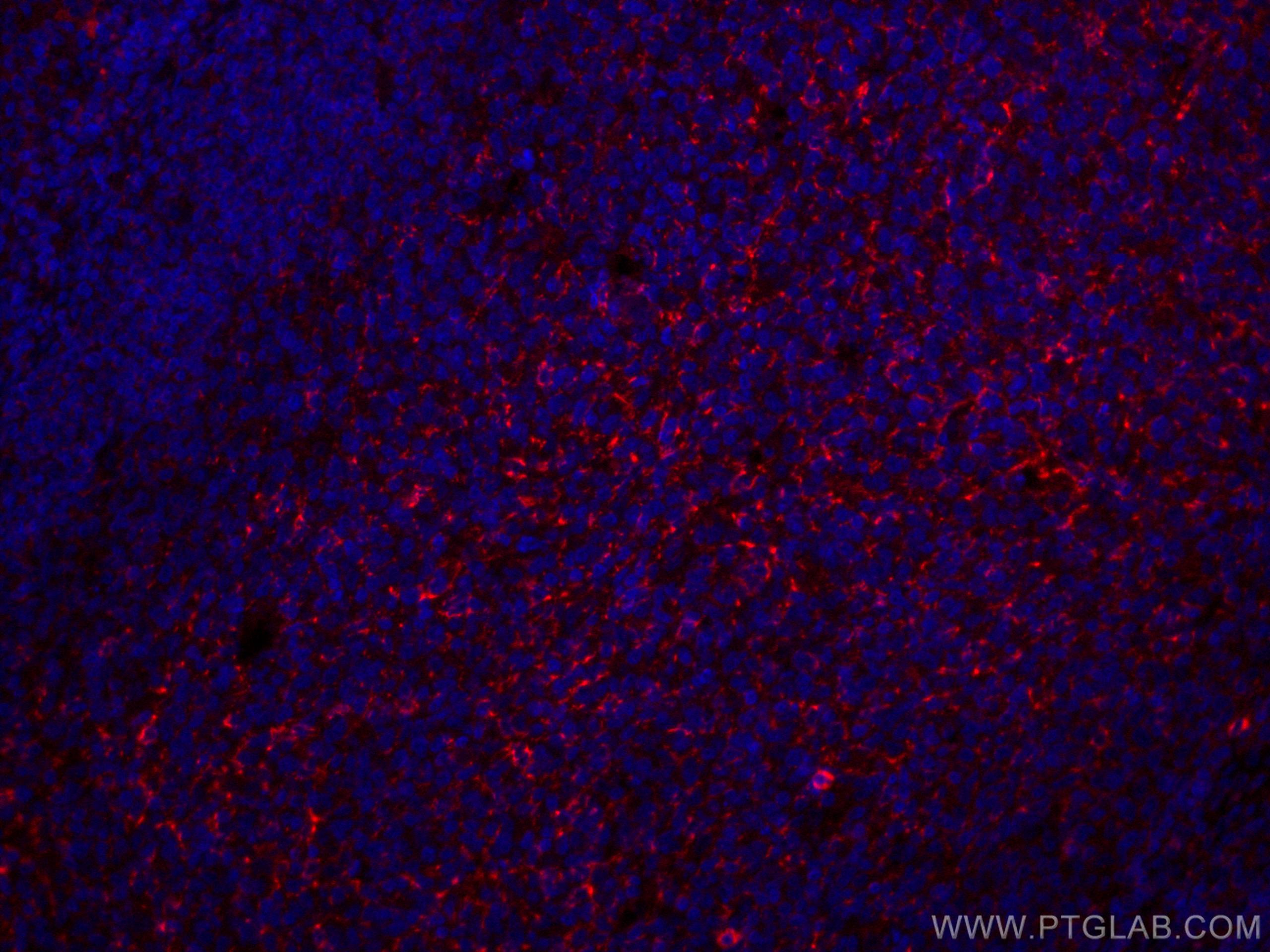 Immunofluorescence (IF) / fluorescent staining of human tonsillitis tissue using CoraLite® Plus 647-conjugated CD70 Monoclonal anti (CL647-67749)