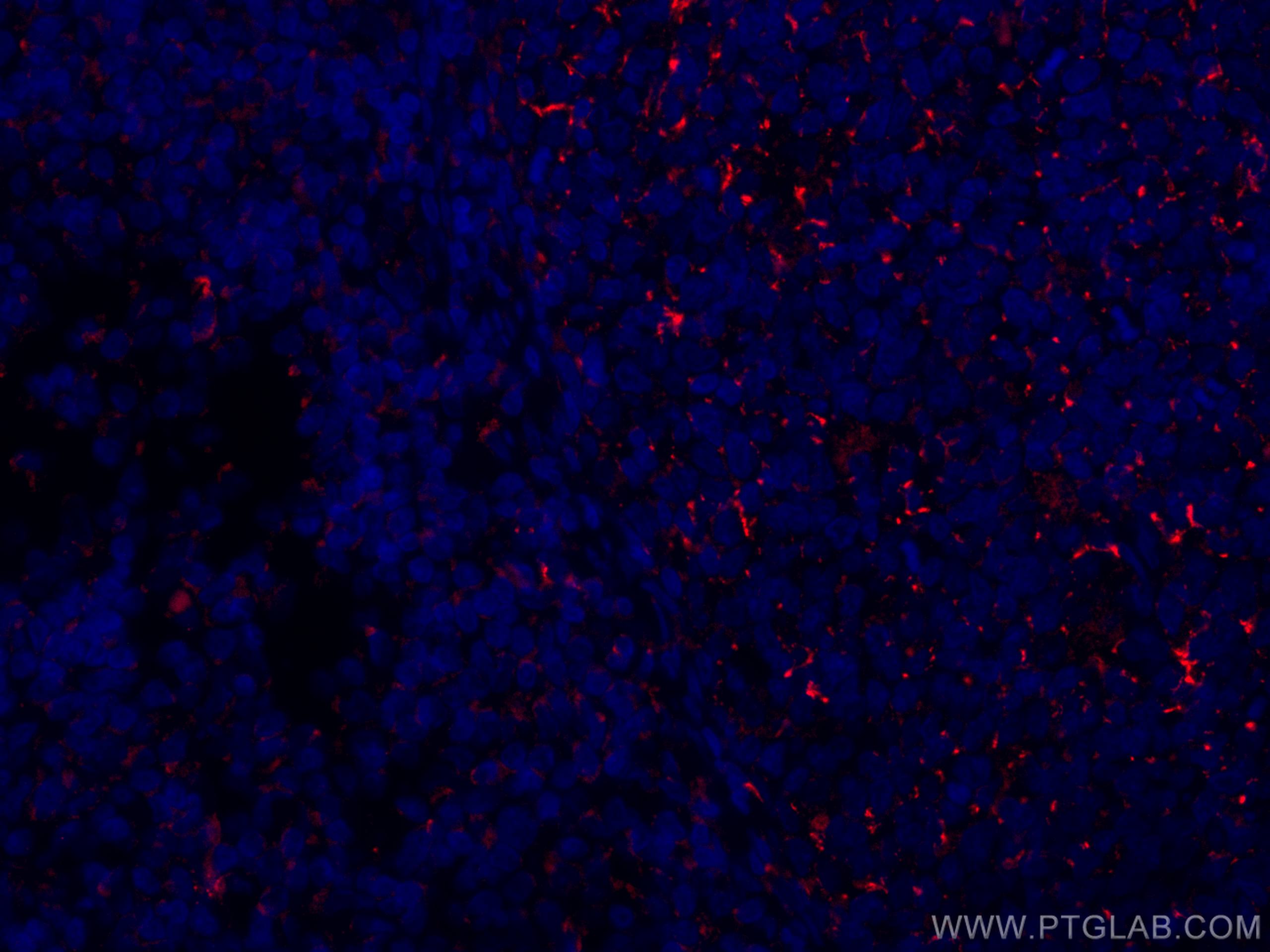 Immunofluorescence (IF) / fluorescent staining of human tonsillitis tissue using CoraLite® Plus 647-conjugated CD70 Monoclonal anti (CL647-67749)