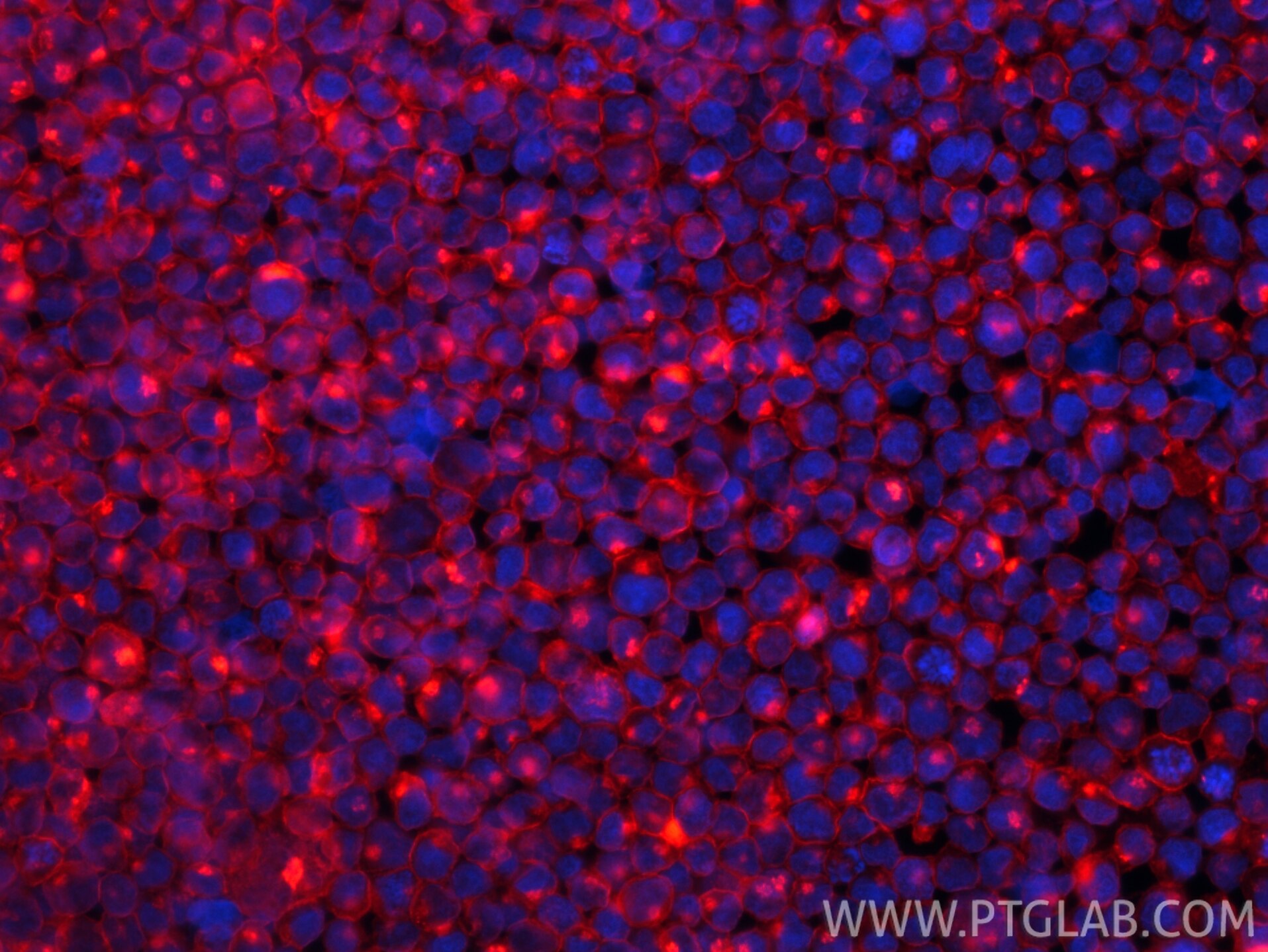 Immunofluorescence (IF) / fluorescent staining of Raji cells using CoraLite®594-conjugated CD70 Recombinant monoclona (CL594-84455-2)