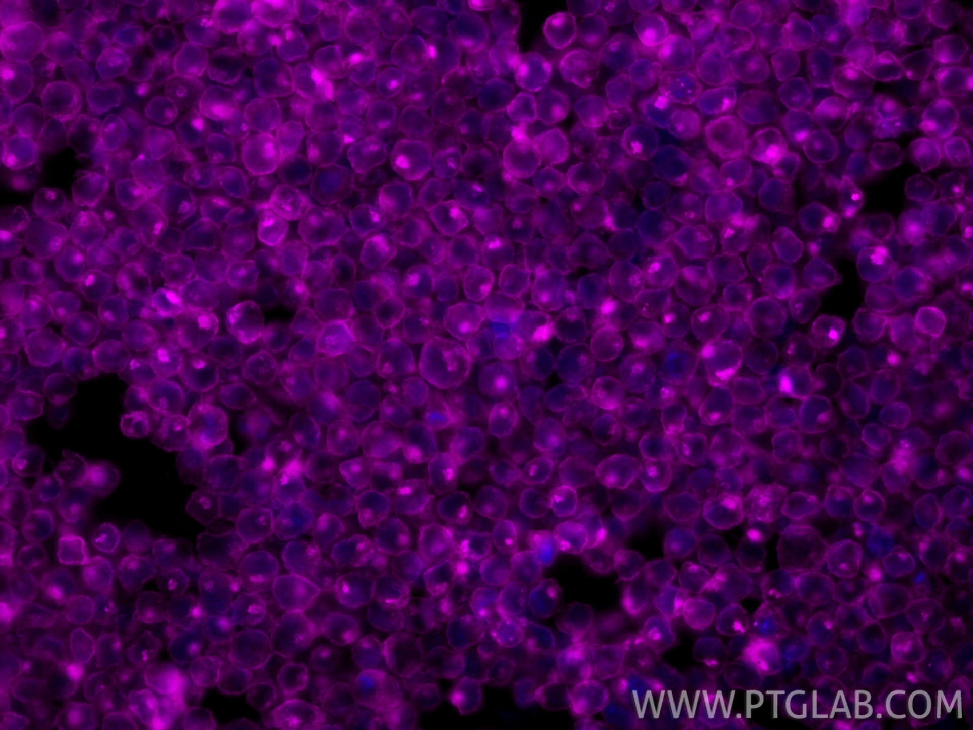 Immunofluorescence (IF) / fluorescent staining of Raji cells using CoraLite® Plus 647-conjugated CD70 Recombinant mon (CL647-84455-2)