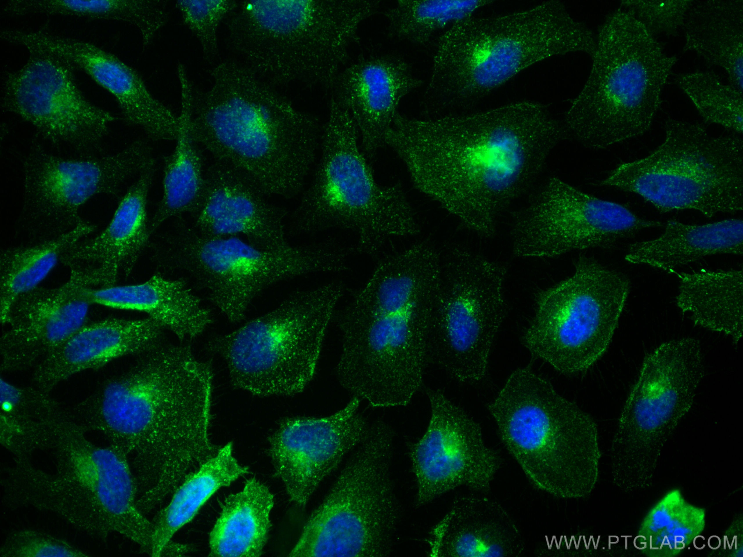 Immunofluorescence (IF) / fluorescent staining of HeLa cells using CD71 Polyclonal antibody (30574-1-AP)
