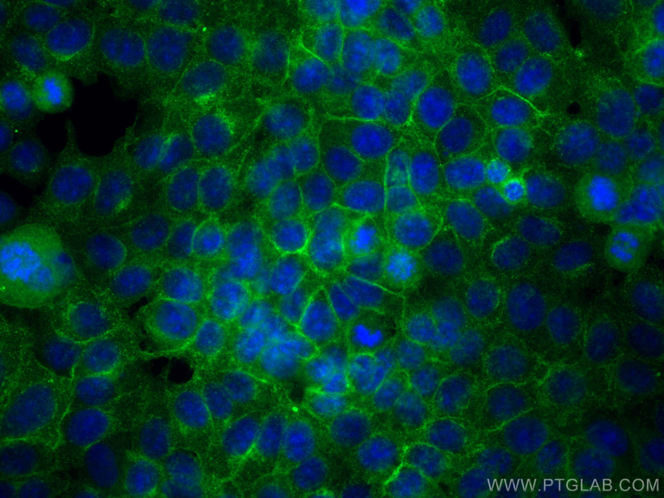 Immunofluorescence (IF) / fluorescent staining of MCF-7 cells using CD71 Polyclonal antibody (30574-1-AP)