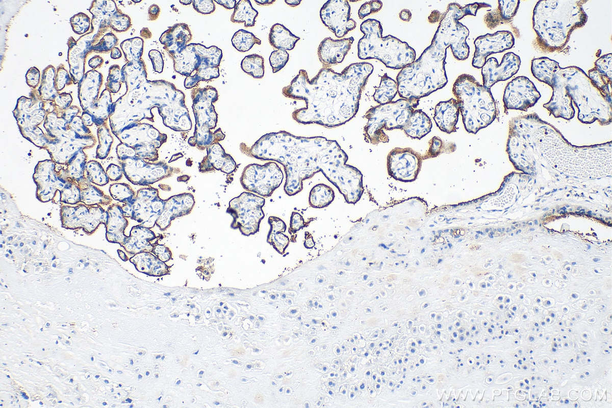 Immunohistochemistry (IHC) staining of human placenta tissue using CD71 Polyclonal antibody (30574-1-AP)