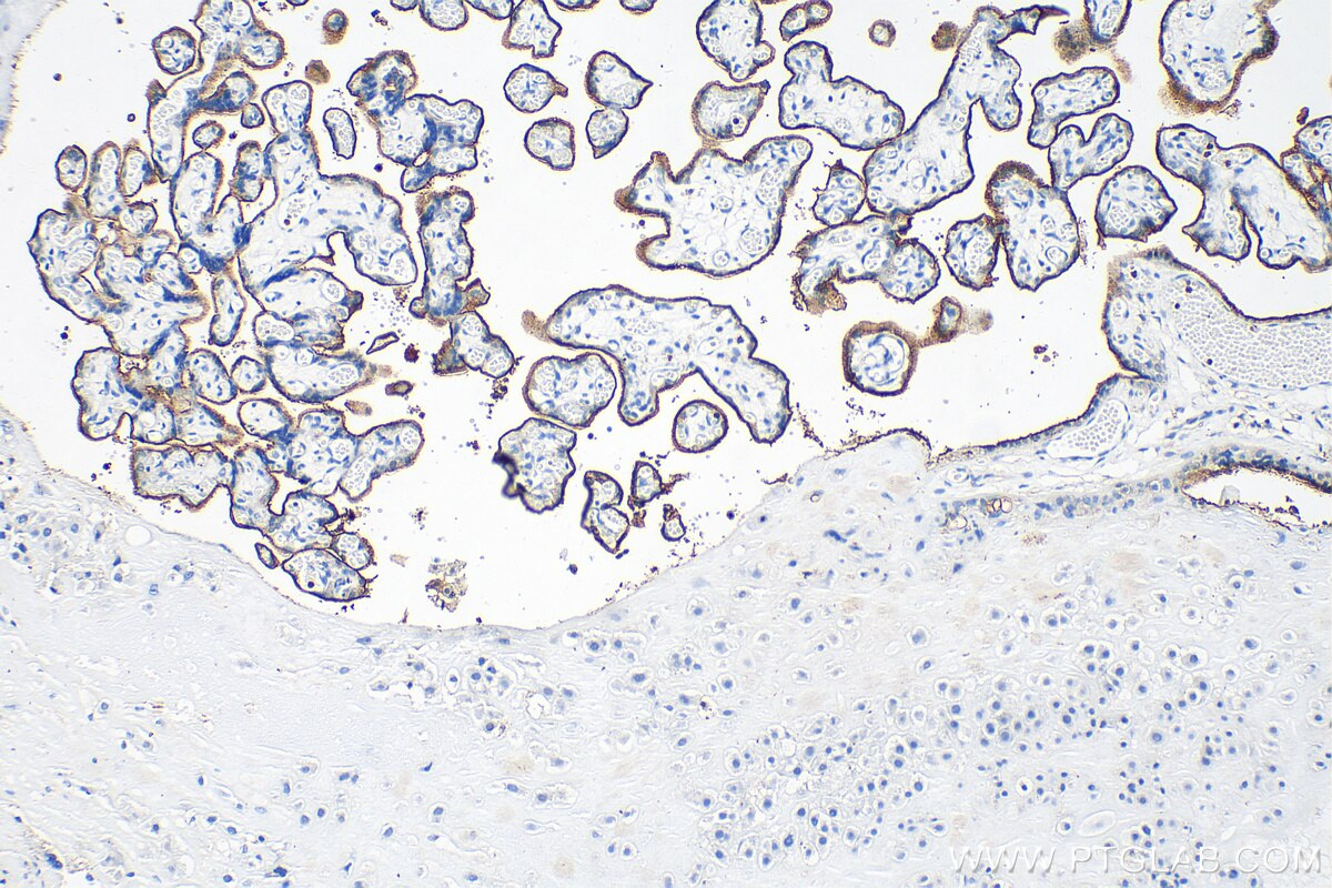 IHC staining of human placenta using 30574-1-AP