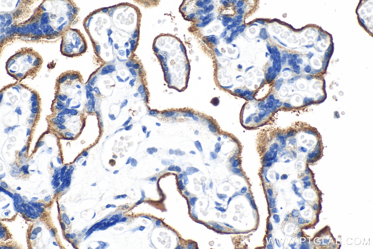 Immunohistochemistry (IHC) staining of human placenta tissue using CD71 Polyclonal antibody (30574-1-AP)