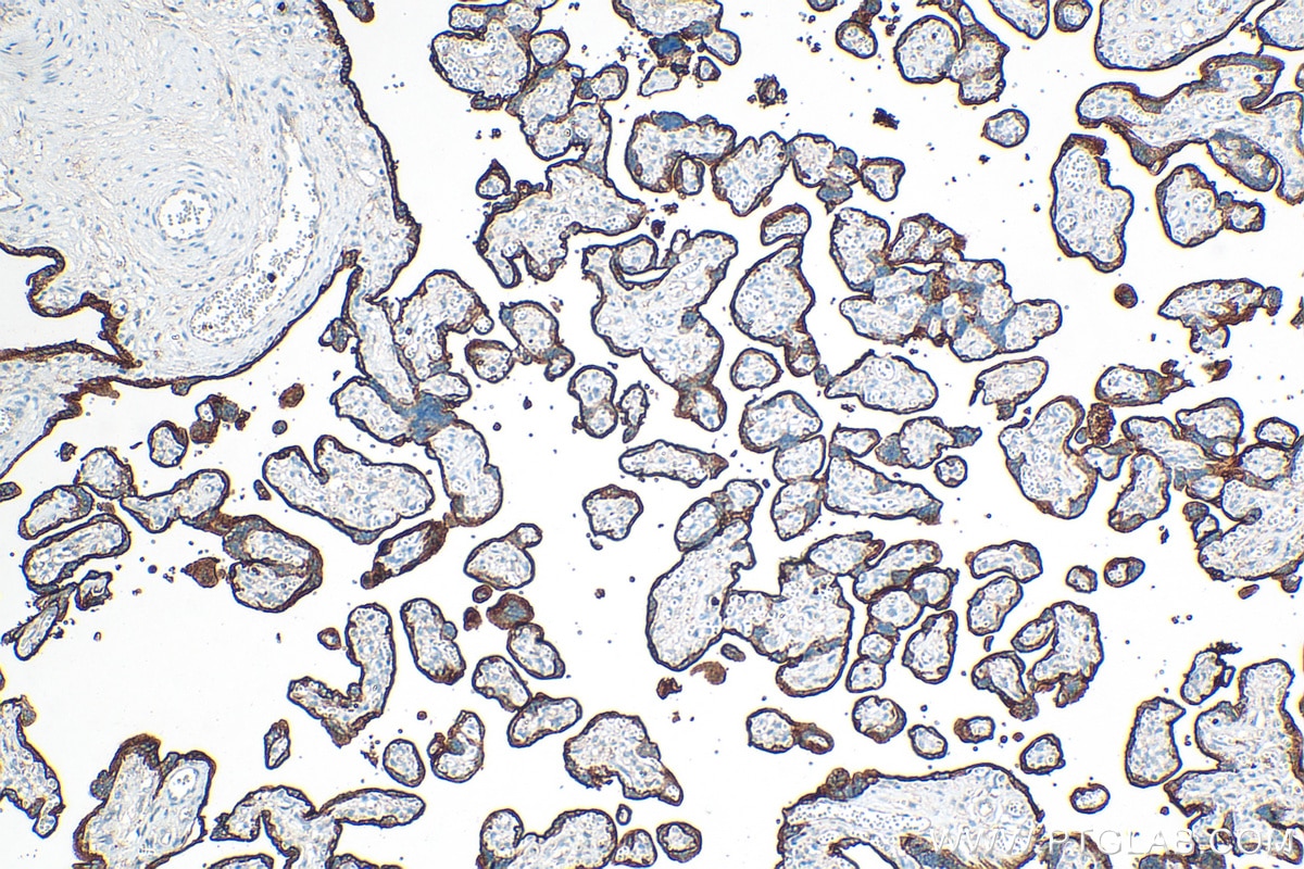Immunohistochemistry (IHC) staining of human placenta tissue using CD71 Polyclonal antibody (30574-1-AP)