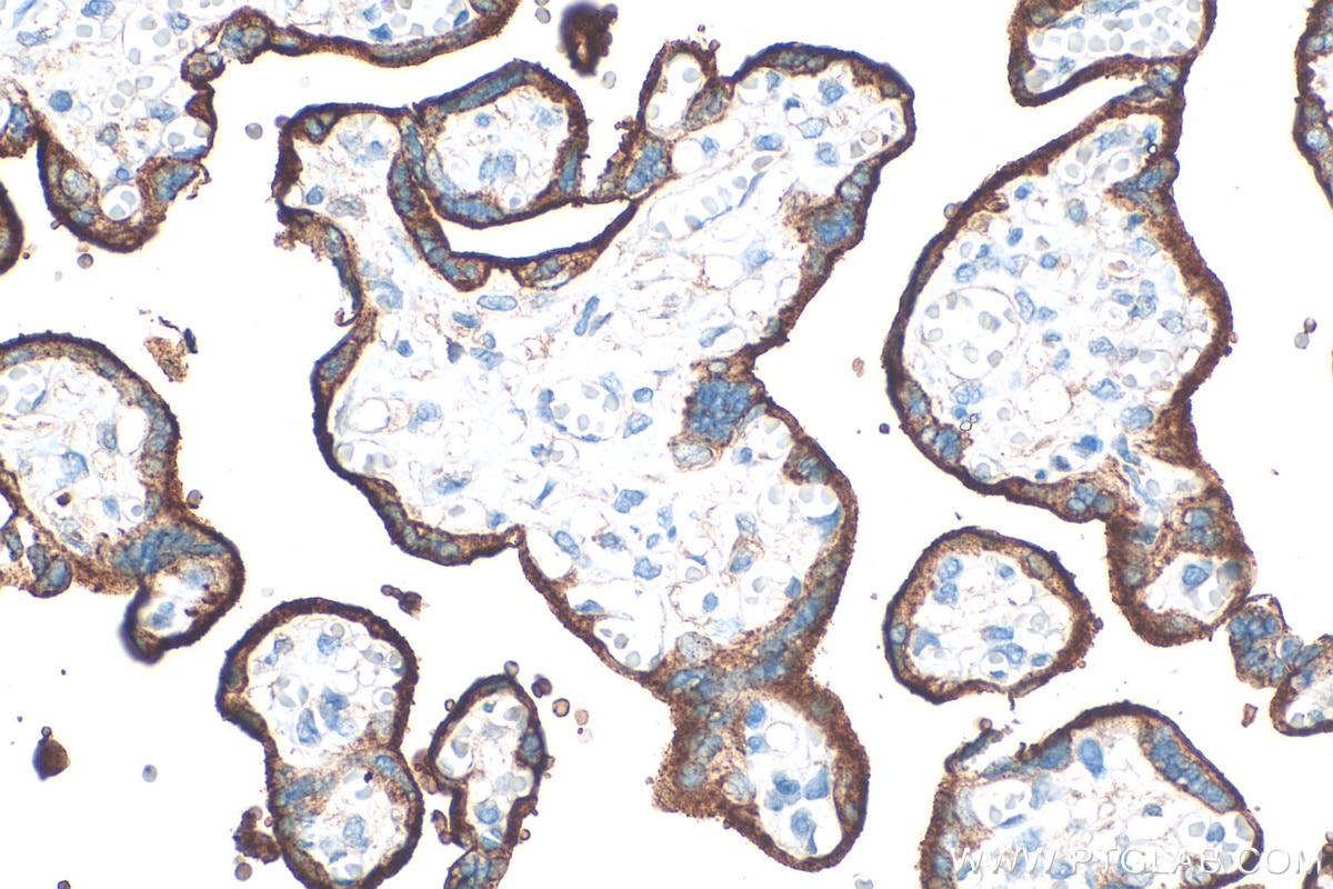 Immunohistochemistry (IHC) staining of human placenta tissue using CD71 Polyclonal antibody (30574-1-AP)
