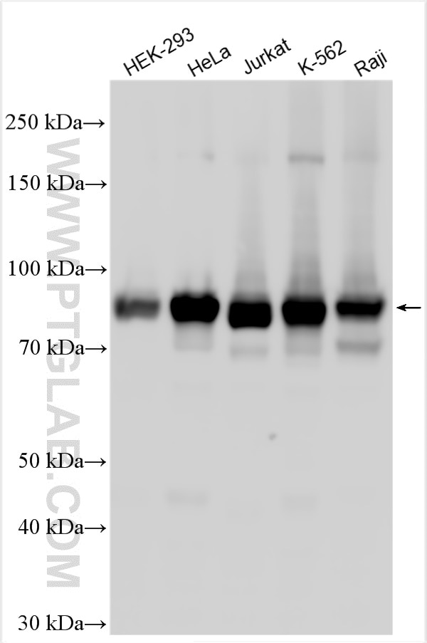 Western Blot (WB) analysis of various lysates using CD71 Polyclonal antibody (30574-1-AP)
