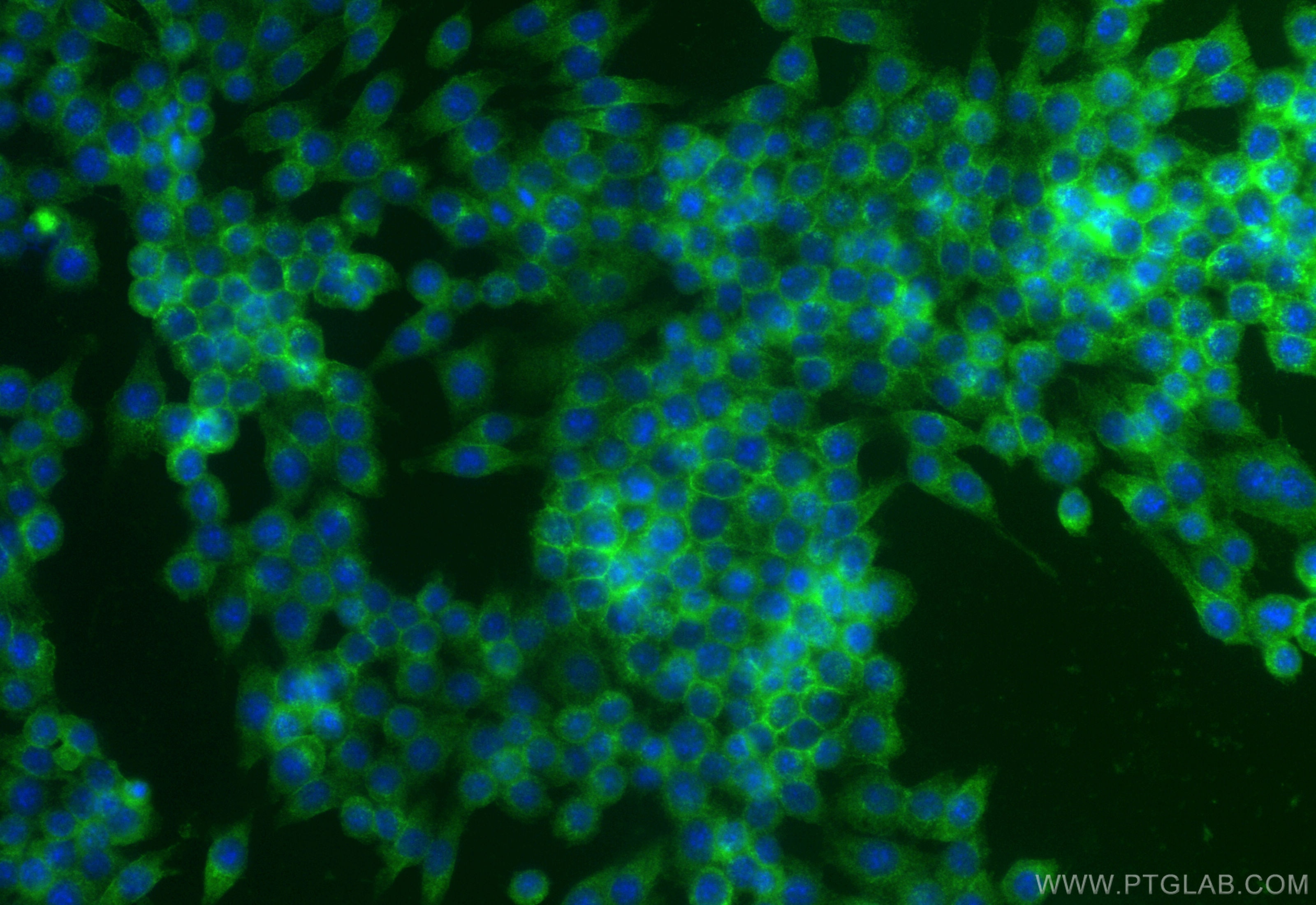 Immunofluorescence (IF) / fluorescent staining of RAW 264.7 cells using CD71 Polyclonal antibody (32333-1-AP)