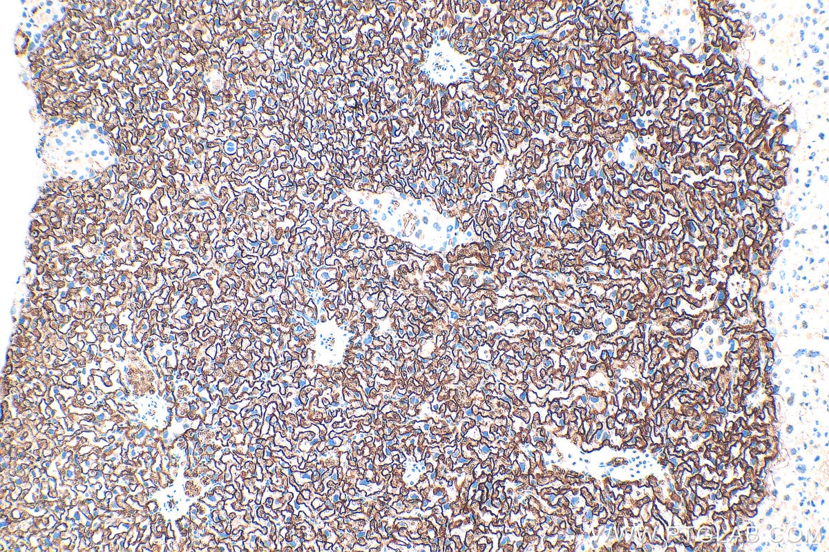 Immunohistochemistry (IHC) staining of mouse placenta tissue using CD71 Polyclonal antibody (32333-1-AP)