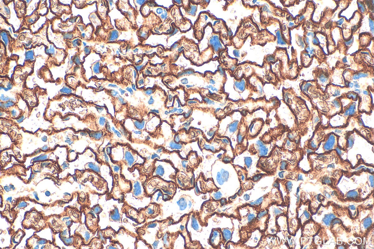 Immunohistochemistry (IHC) staining of mouse placenta tissue using CD71 Polyclonal antibody (32333-1-AP)