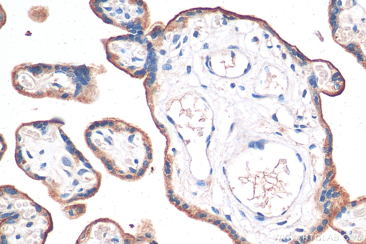 Immunohistochemistry (IHC) staining of human placenta tissue using CD71 Monoclonal antibody (65236-1-Ig)
