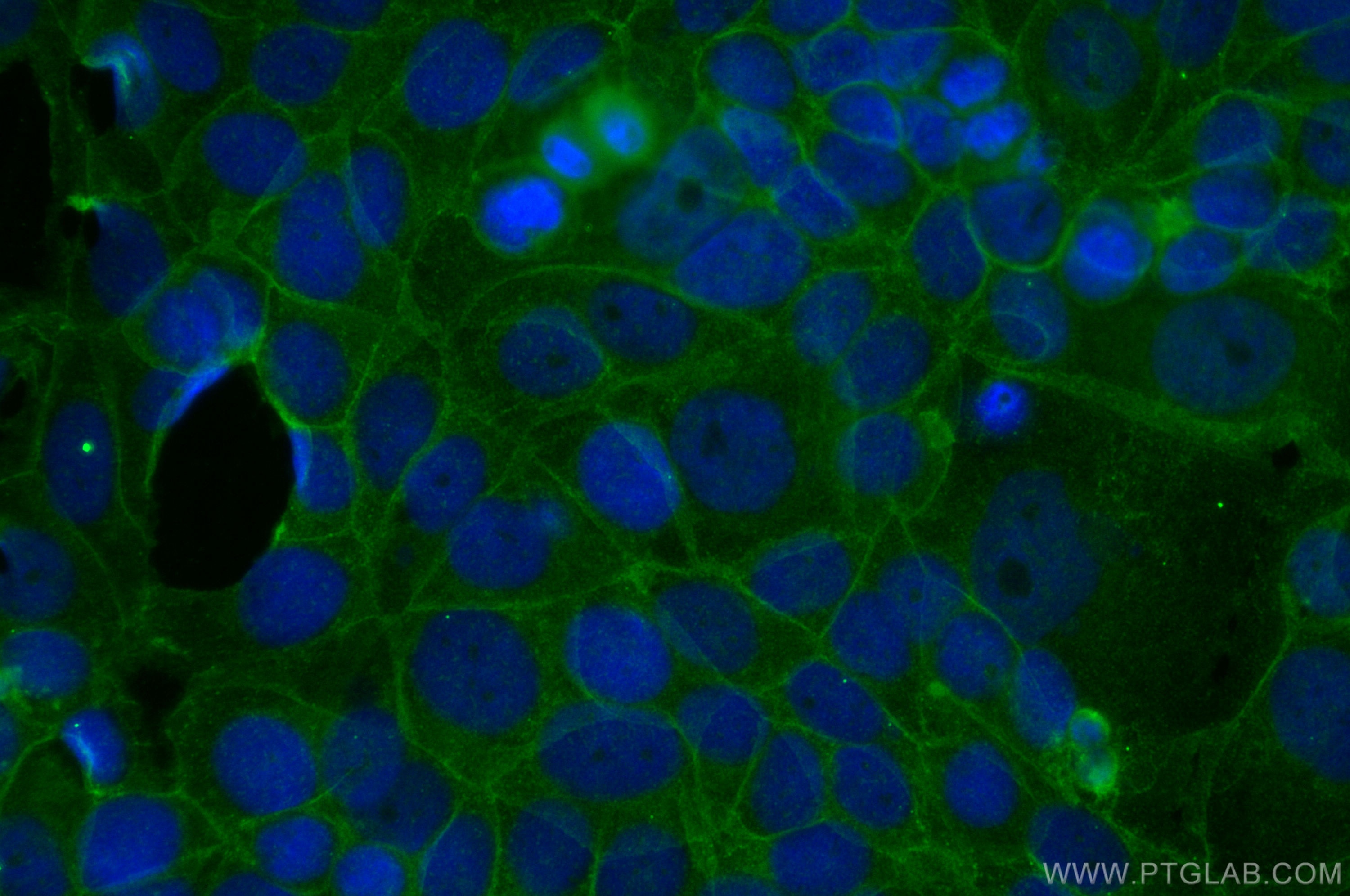 Immunofluorescence (IF) / fluorescent staining of MCF-7 cells using CD71 Monoclonal antibody (66180-1-Ig)
