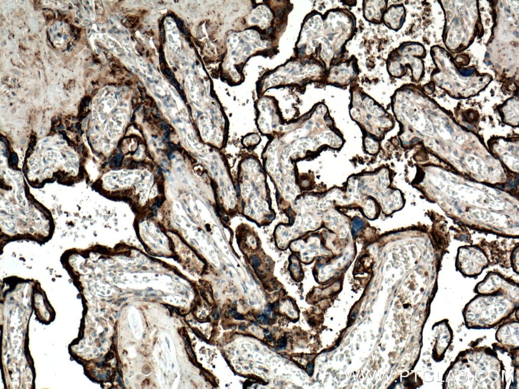 Immunohistochemistry (IHC) staining of human placenta tissue using CD71 Monoclonal antibody (66180-1-Ig)