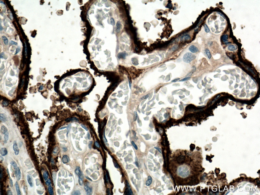 Immunohistochemistry (IHC) staining of human placenta tissue using CD71 Monoclonal antibody (66180-1-Ig)
