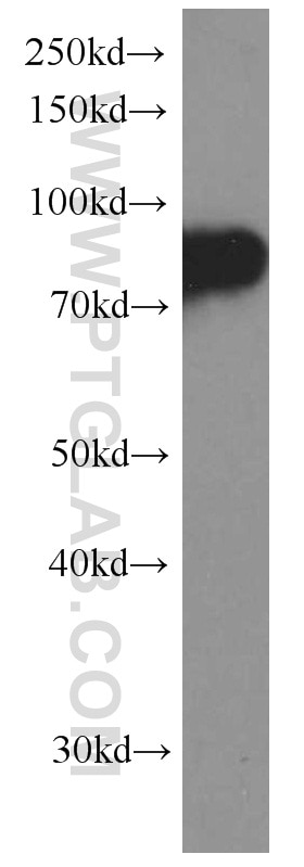 CD71 Monoclonal antibody