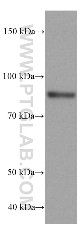 Western Blot (WB) analysis of A549 cells using CD71 Monoclonal antibody (66180-1-Ig)