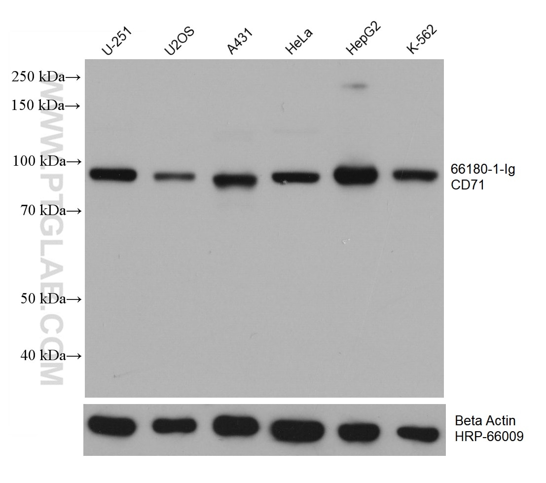 WB analysis using 66180-1-Ig