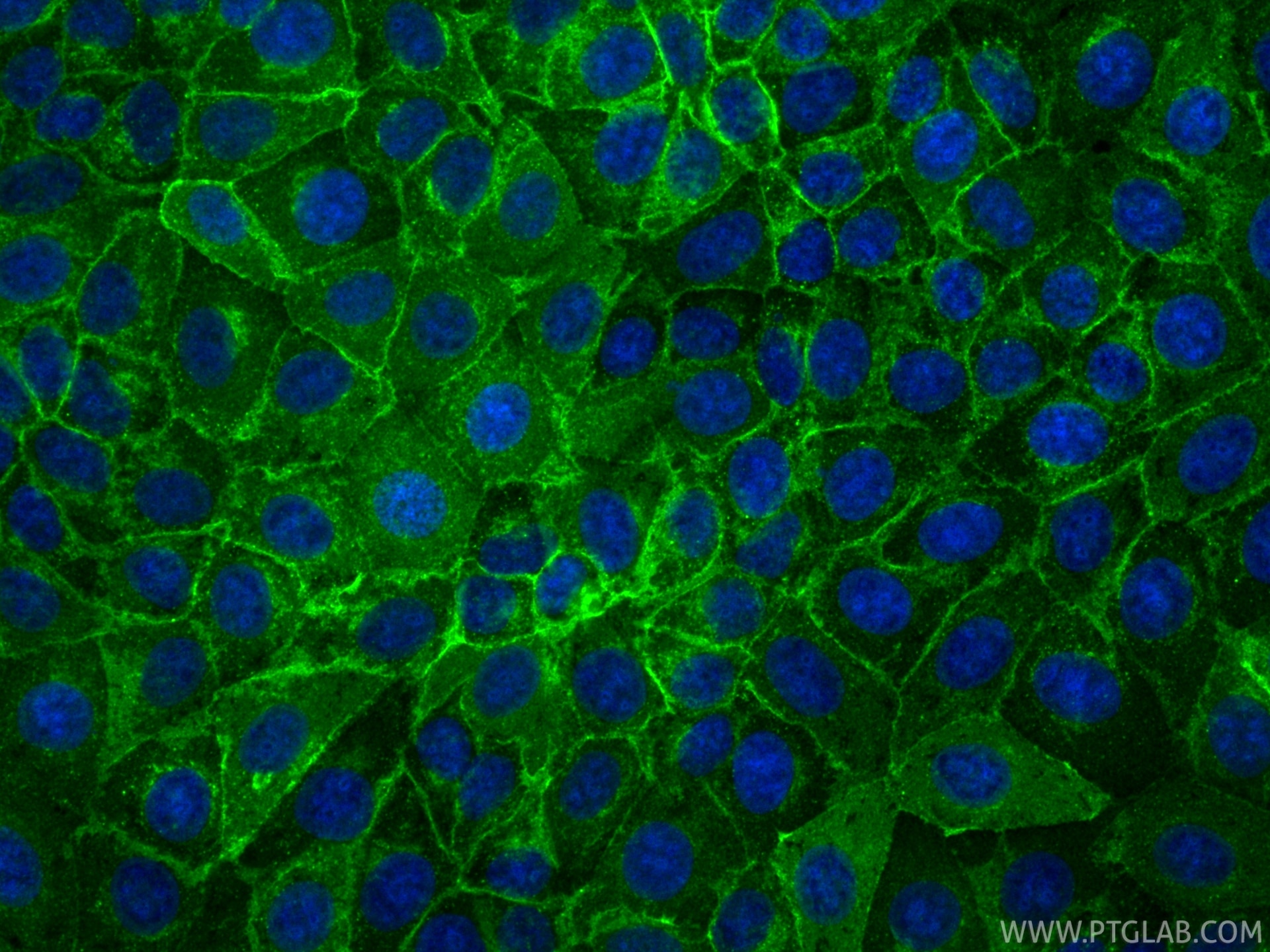 IF Staining of MCF-7 using 81793-13-RR Immunofluorescence (IF) / fluorescent staining of MCF-7 cells using CD71 Recombinant monoclonal antibody (81793-13-RR)