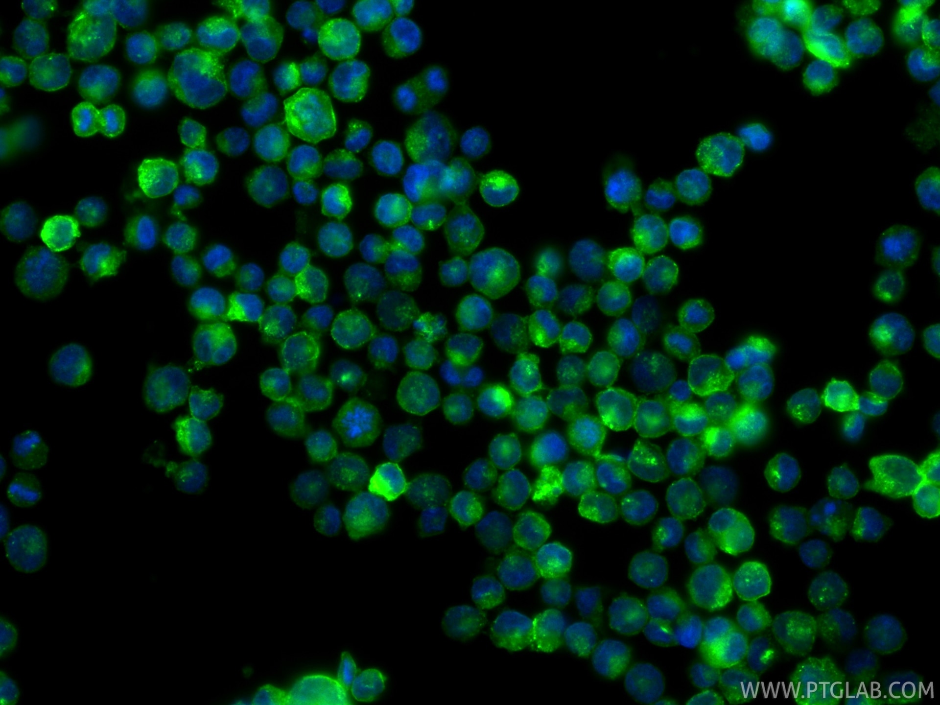 IF Staining of K-562 using 81793-13-RR Immunofluorescence (IF) / fluorescent staining of K-562 cells using CD71 Recombinant monoclonal antibody (81793-13-RR)