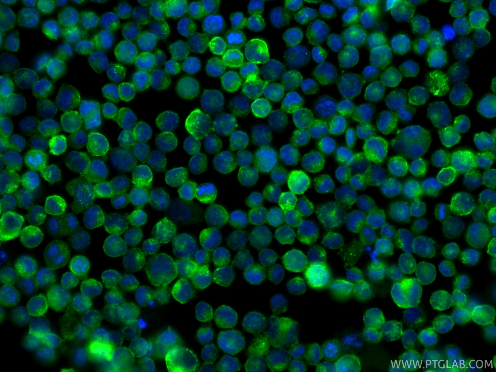 IF Staining of K-562 using 81793-14-RR Immunofluorescence (IF) / fluorescent staining of K-562 cells using CD71 Recombinant monoclonal antibody (81793-14-RR)