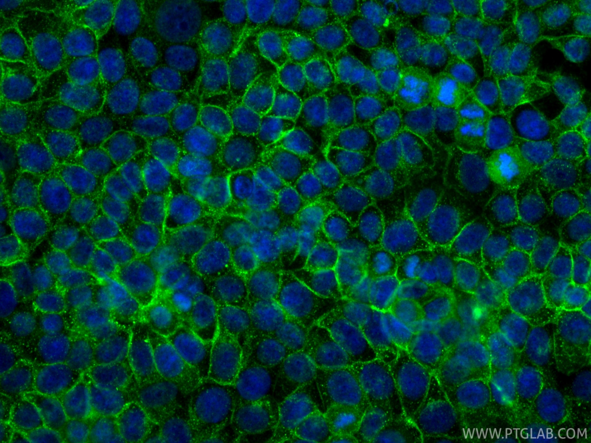 IF Staining of MCF-7 using 81793-3-RR Immunofluorescence (IF) / fluorescent staining of MCF-7 cells using CD71 Recombinant monoclonal antibody (81793-3-RR)