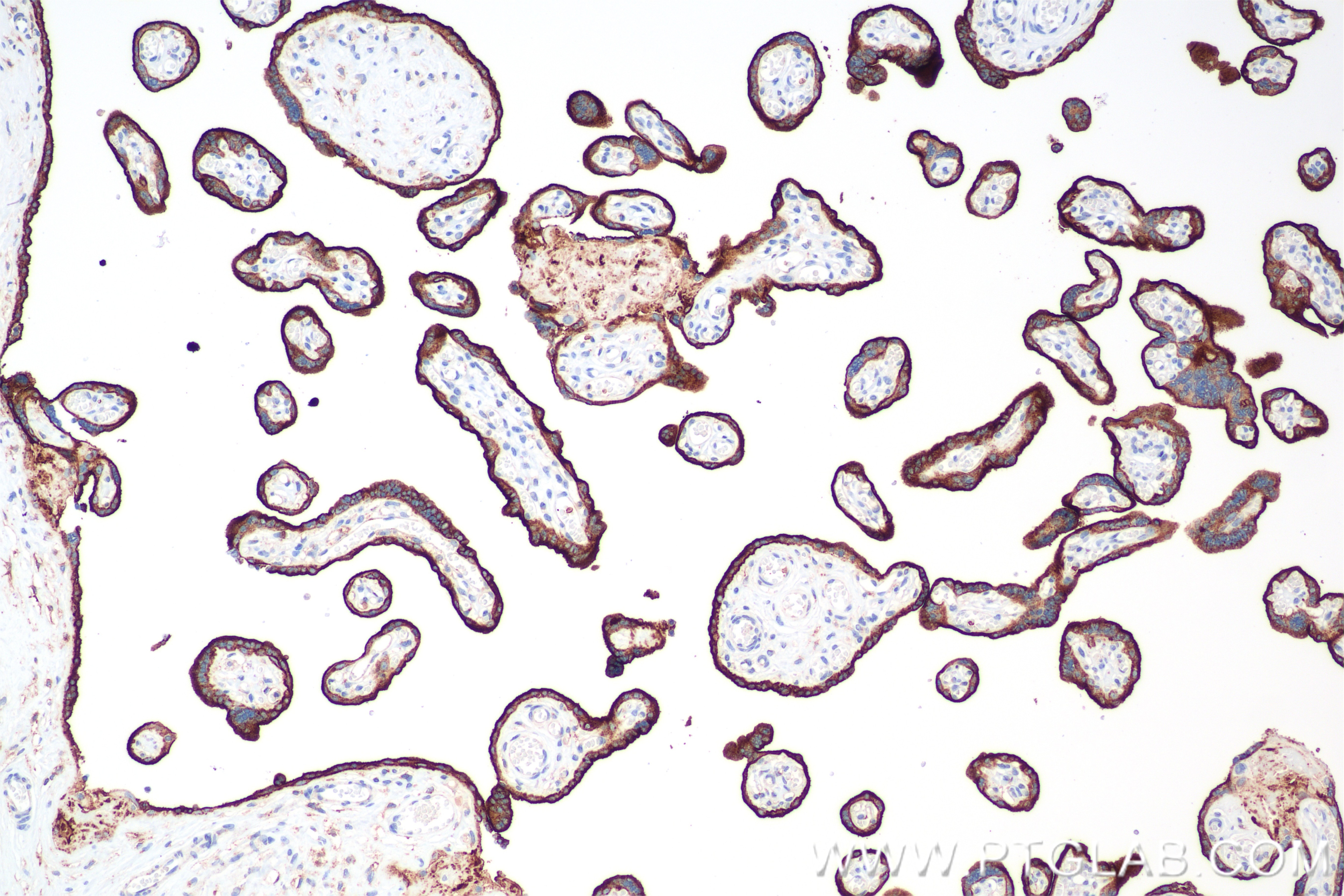 Immunohistochemistry (IHC) staining of human placenta tissue using CD71 Recombinant antibody (81793-3-RR)