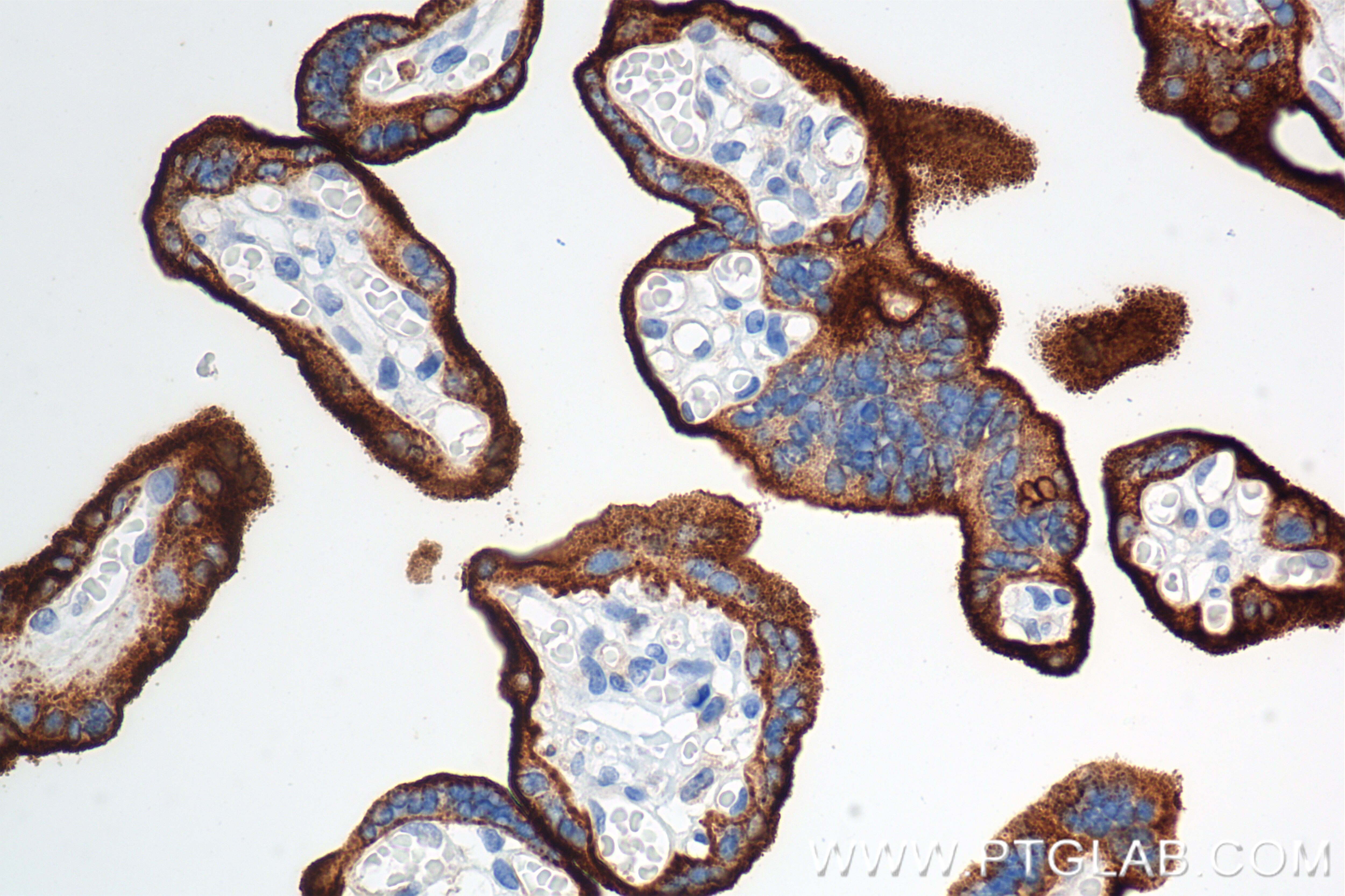 Immunohistochemistry (IHC) staining of human placenta tissue using CD71 Recombinant antibody (81793-3-RR)
